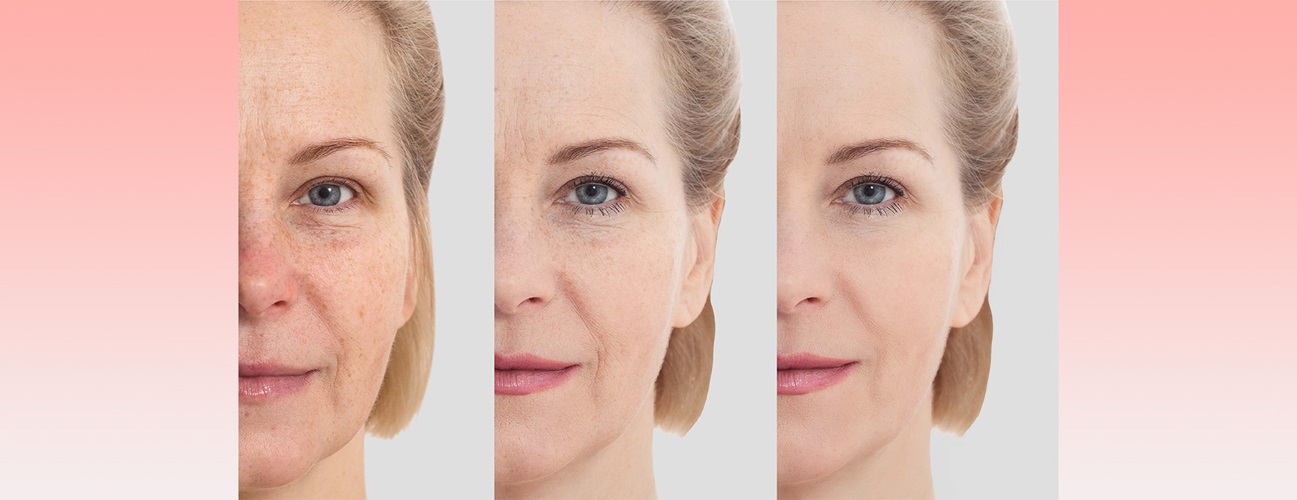 The transformational power of MedSpa treatments: A before-and-after glimpse.